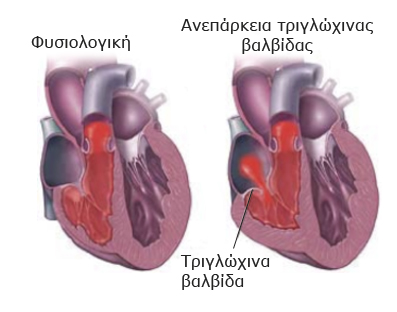 Aneparkeia trigloxinas